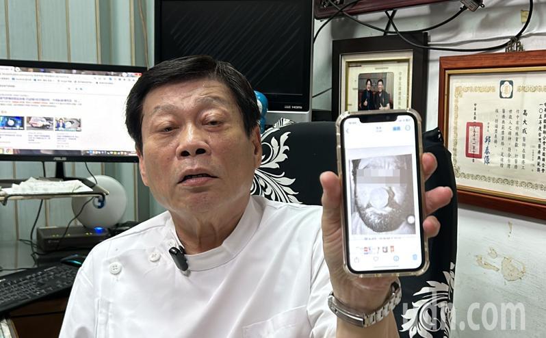 中山醫學大學附設醫院法醫科主任高大成說明,一般生前溺水,被救起後約5至10分鐘,會如同手機中顯示的照片一樣,其口、鼻會產生泡沫。記者趙容萱/攝影 中山醫學大學附設醫院法醫科主任高大成說明,一般生前溺水,被救起後約5至10分鐘,會如同手機中顯示的照片一樣,其口、鼻會產生泡沫。記者趙容萱/攝影
