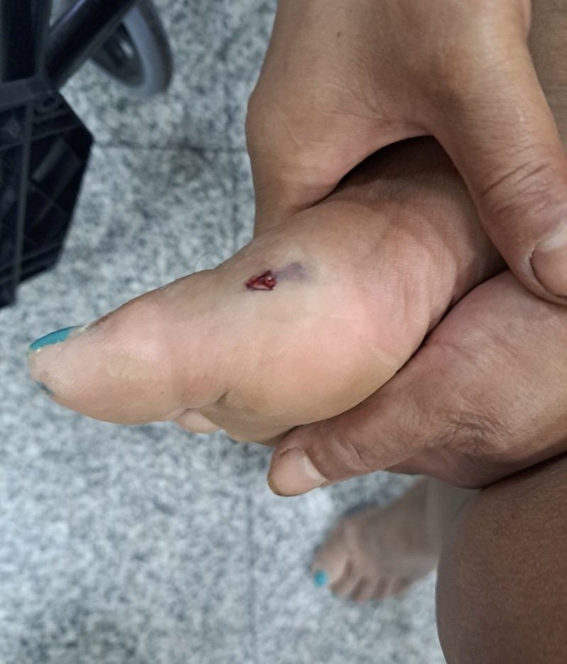 趙姓婦人昨傍晚在山區工作時右腳遭咬傷,緊急向桃園市消防局第一救災救護大隊迴龍分隊求救,救護員檢傷發現是毒蛇咬的,趕緊將她送往有血清的醫院救治,今天上午已平安出院。記者陳恩惠/翻攝 趙姓婦人昨傍晚在山區工作時右腳遭咬傷,緊急向桃園市消防局第一救災救護大隊迴龍分隊求救,救護員檢傷發現是毒蛇咬的,趕緊將她送往有血清的醫院救治,今天上午已平安出院。記者陳恩惠/翻攝