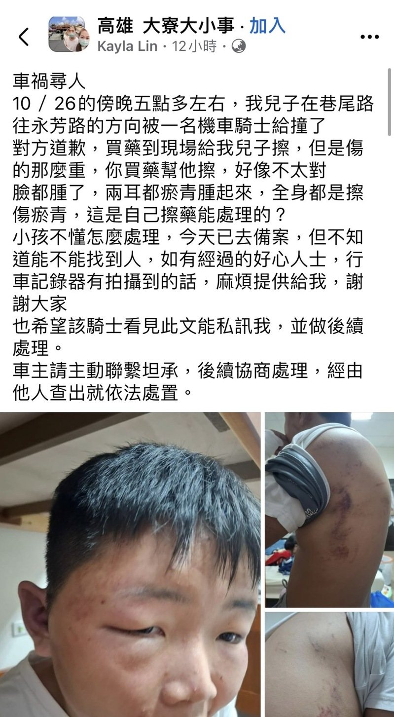 高市一名林姓女子在網路貼文指兒子26日傍晚5點多在巷尾路往永芳路方向被一名機車騎士撞了,對方道歉後,到藥局買藥給兒子擦之後就離開。圖/取自臉書社團「高雄大寮大小事」 高市一名林姓女子在網路貼文指兒子26日傍晚5點多在巷尾路往永芳路方向被一名機車騎士撞了,對方道歉後,到藥局買藥給兒子擦之後就離開。圖/取自臉書社團「高雄大寮大小事」